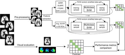 Automated differential diagnosis of dementia syndromes using FDG PET and machine learning
